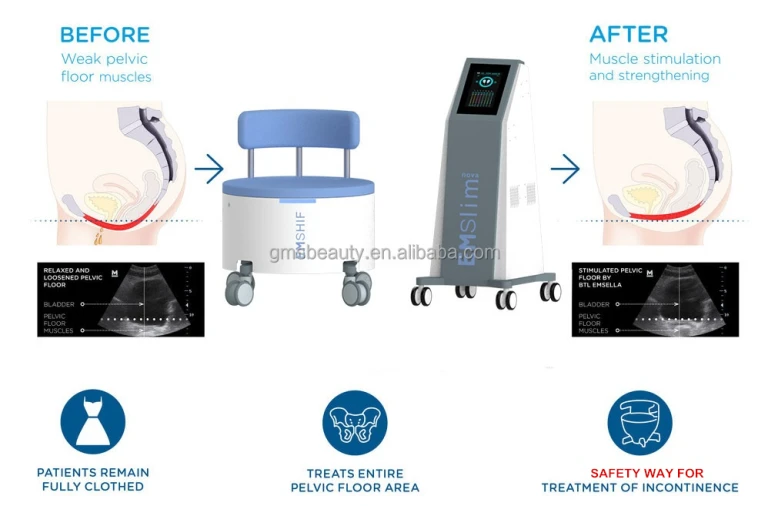 EMSlim Pelvic Floor Training