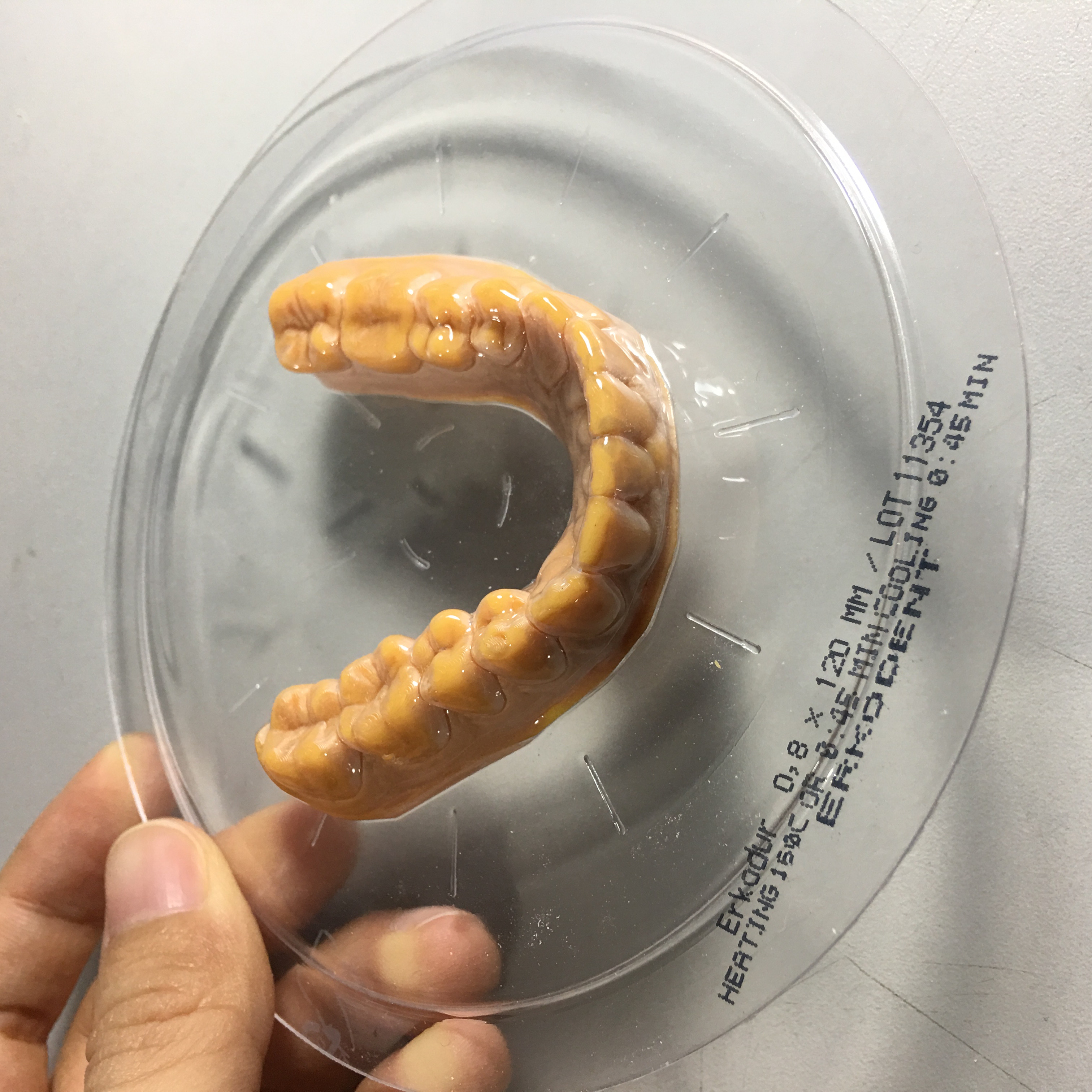 Custom Clear Aligners