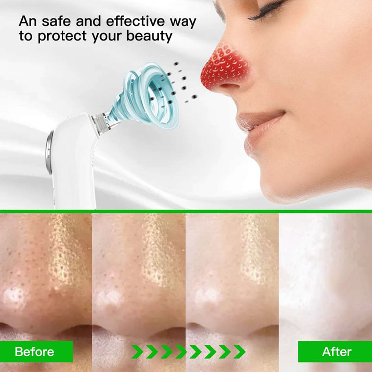Three-in-one Anti-aging Skin Care Beauty Instrument Facial Blackhead Remover Hot and Cold Facial Massager with Makeup Remover
